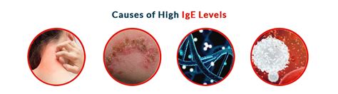 Is High IgE Level Dangerous | Ganesh Diagnostic