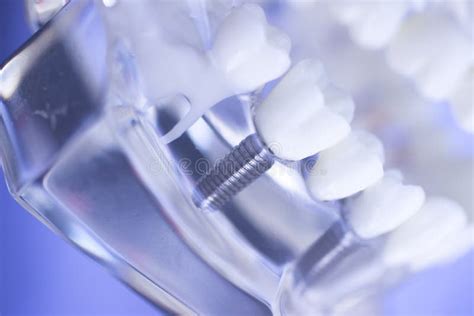 Dental teeth mouth model stock photo. Image of healthy - 101655978