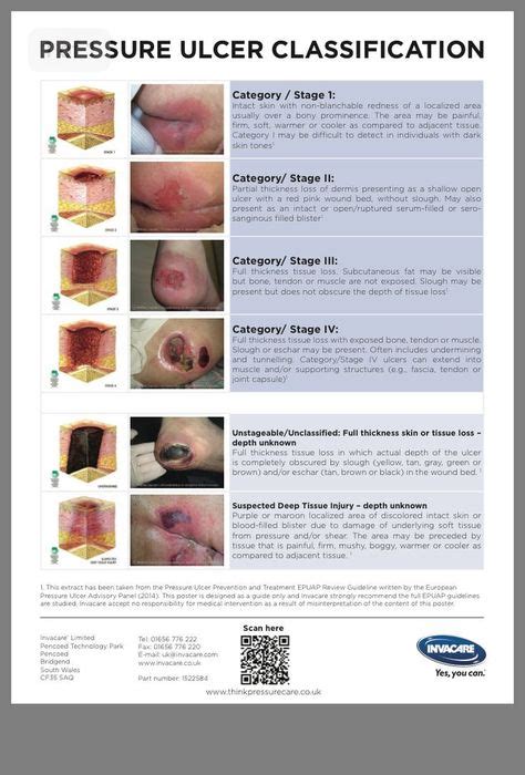 chirurgische Pflege klassifizieren Dekubitus (mit Bildern ...
