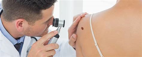 Skin biopsy to diagnose skin cancer