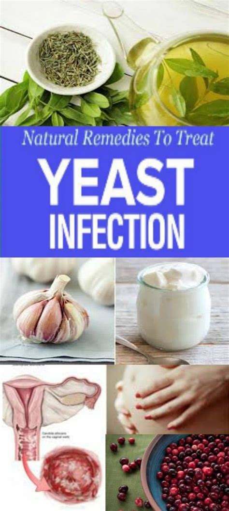 Natural Remedies To Treat Yeast Infection (With images) | Treat yeast ...