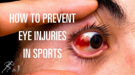 How to prevent eye injuries in sports and exercise - YouTube