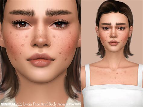 The Sims Resource - MinimalSim - Lucia Face And Body Acne