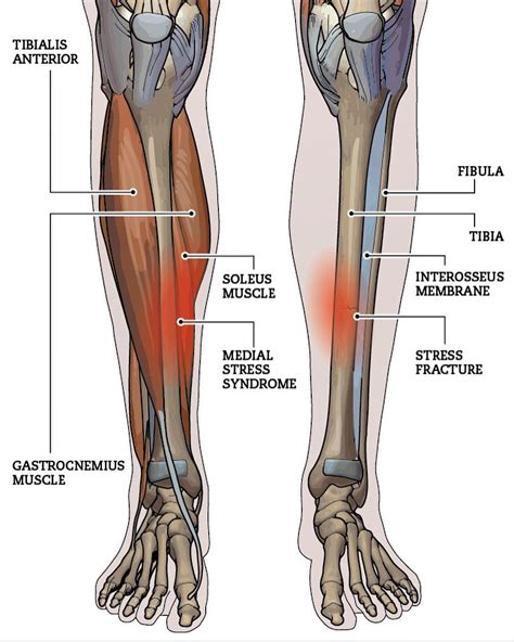 Shin Pain - Vasta Performance Training and Physical Therapy