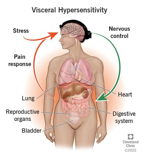 Visceral Hypersensitivity: Symptoms, Treatment, Causes & What it Is