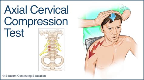 Axial Cervical Compression Test - A Chiropractic Online CE™ Production ...