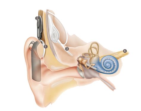 Hearing Aid & Cochlear Implant Services | Faith Hearing Specialists