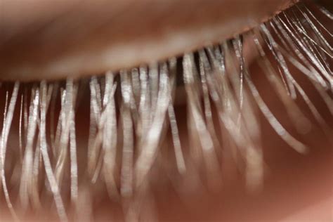 Lash lice becoming more common in eyelash extensions – some doctors are ...