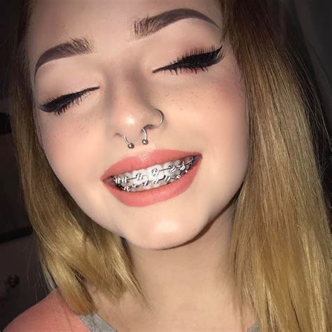 ᴘɪɴᴛᴇʀᴇsᴛ ⋆ ᴊᴏᴜɪʀxʙɪᴛᴄʜ | Smiley piercing, Dental braces, Brace face