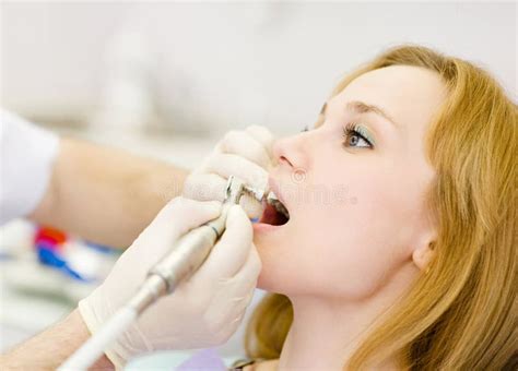 Close-up Dentist Procedure of Teeth Polishing with Clean Stock Image ...