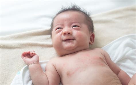 Baby & Child Eczema: Symptoms, Causes, Treatment & FAQs - ilovenatural.store