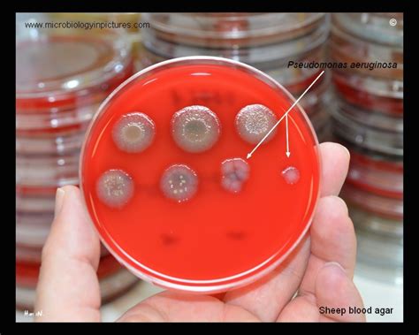 Pseudomonas Aeruginosa On Blood Agar Microbekeeper Flickr, 42% OFF