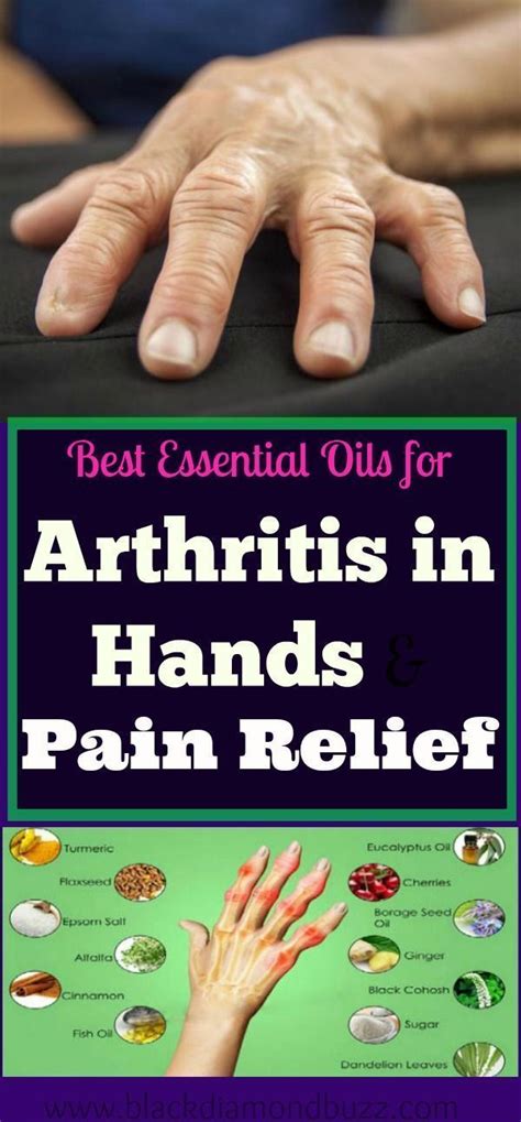 Pin on Arthritis Remedies