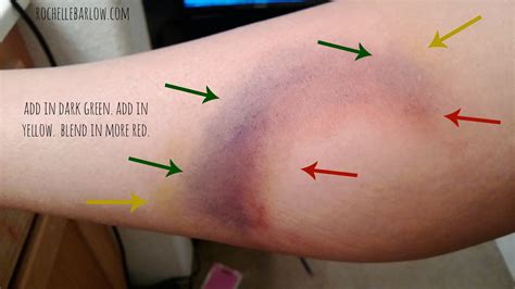 How To Cover A Purple Bruise With Makeup | Legacy.teapigs.co.uk