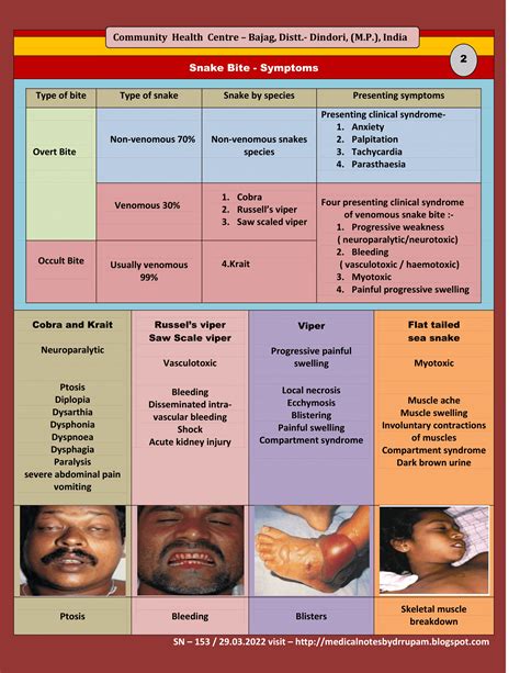 Medical Notes For Students: Snake Bite -2 (Symptoms)