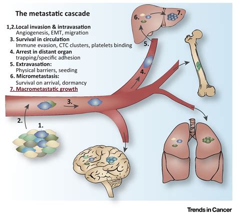 Surviving at a Distance: Organ-Specific Metastasis: Trends in Cancer