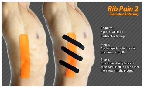 Physical Therapy Exercises For Broken Ribs - Exercise Poster