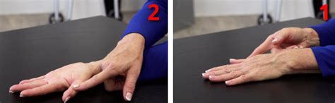 9 Rehabilitating Hand Exercises