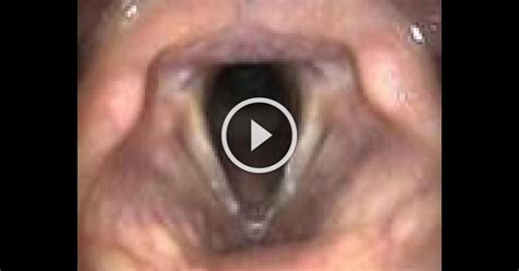 Anatomical Tutorial During Trans-Nasal Endoscopy ! | Tutorial, Anatomical, Trans