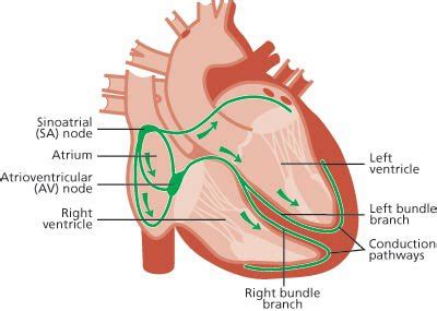 Normal sinus rhythm with ventricular ectopics | Great Ormond Street Hospital