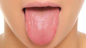 Causes And How To Treat Cut On Tongue ? - Yabibo