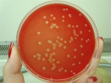 De cómo una infección estomacal puede disparar síntomas de enfermedades mentales (ESTUDIO)