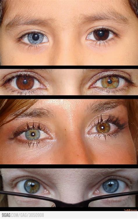 Can Heterochromia just happen? | SiOWfa15: Science in Our World ...