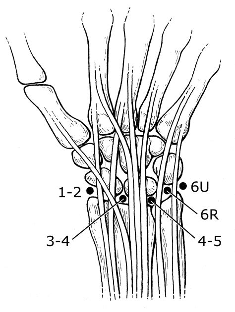 Wrist Arthroscopy - OrthoInfo - AAOS