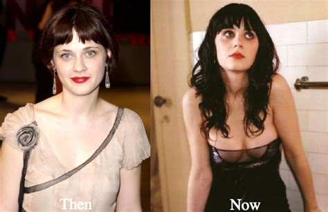 Zooey Deschanel Plastic Surgery Before and After Photos - Latest ...