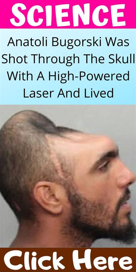 Anatoli Bugorski Was Shot Through The Skull With A High-Powered Laser And Lived | Higher power ...