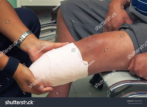 4,442 Limb Amputation Images, Stock Photos & Vectors | Shutterstock