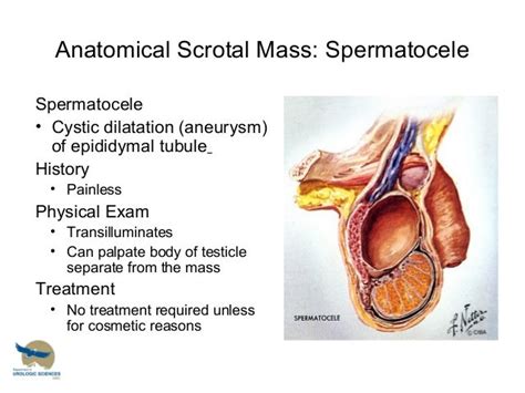 Scrotal masses and Testicular tumors