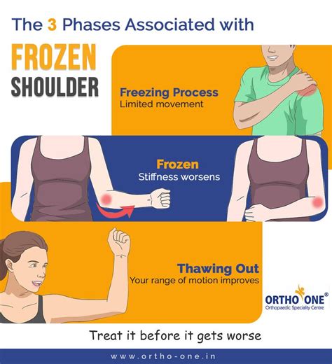 Pin on Shoulder Problems