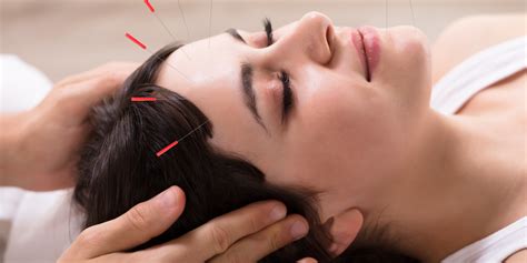 Acupuncture For Anxiety And Depression: Does It Really Work?