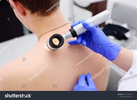 Dermatoscopy Images, Stock Photos & Vectors | Shutterstock