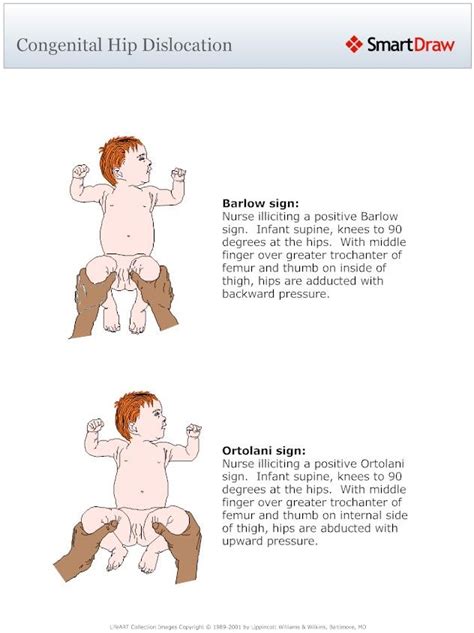 congenital hip dislocation | Nursing school survival, Pediatric nursing, Hip dislocation