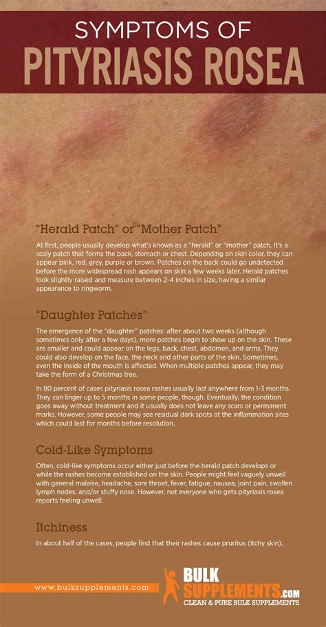 Pityriasis Rosea: Symptoms, Causes & Treatment by James Denlinger