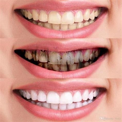 10 Best Active Charcoal Toothpaste of 2022