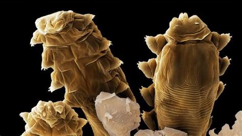 These microscopic mites live on your face | Demodex, Face, Micro photography