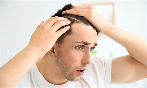 What Are the Early Signs of Balding? - Haista Clinic