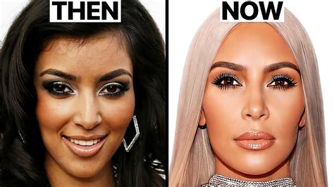 Kim Kardashian's New Face | Plastic Surgery Analysis :: GentNews