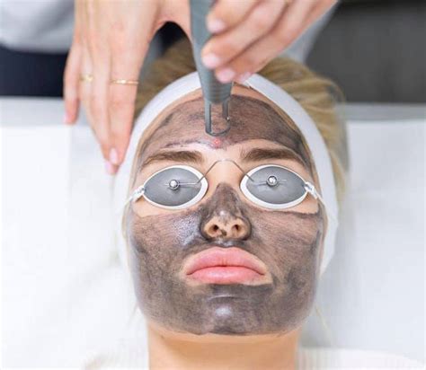 Facials | Carbon Laser Peel Facial | Koha Skin Clinic