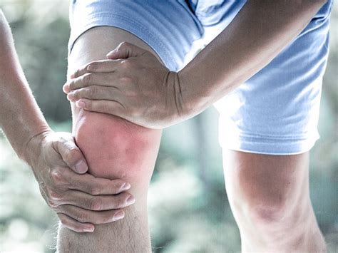 Gout Knee Causes Symptoms Treatment Knee Pain Explain - vrogue.co