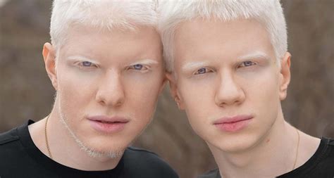 Bera Ivanishvili and brother Tsotne – this is the albino brothers today