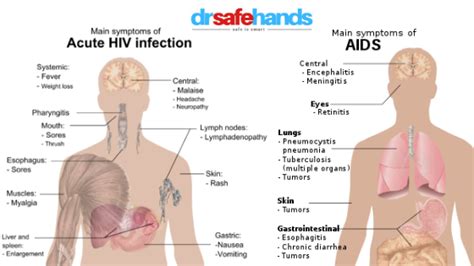 Know HIV AIDS Facts : Symptoms and Treatments