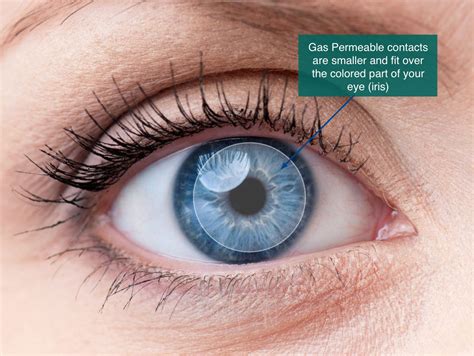 Gas Permeable Contact Lenses in Oklahoma City