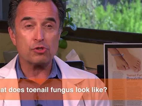 What does toenail fungus look like? - video Dailymotion