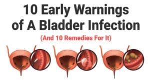 10 Early Warnings of A Bladder Infection (And 10 Remedies For It)