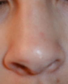 File:Human-nose.jpg - Wikimedia Commons