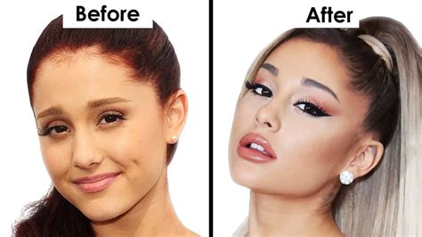 Ariana Grande Before and After Plastic Surgery